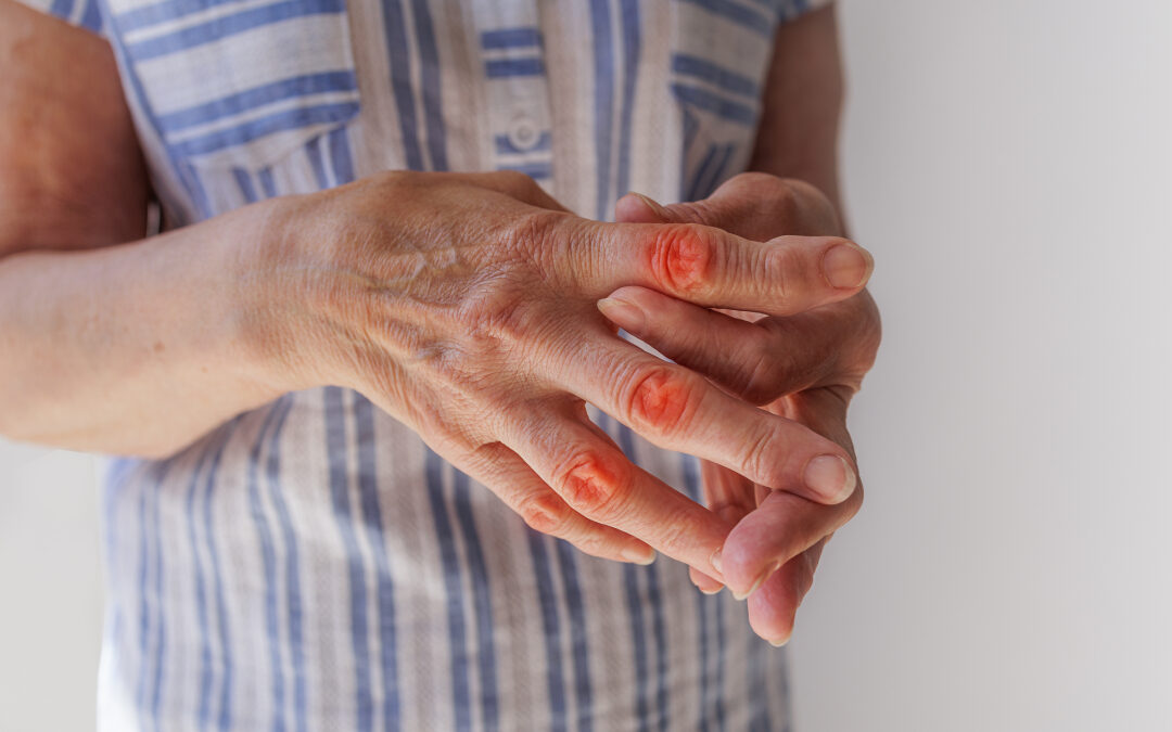 Consejos para la persona con artrosis
